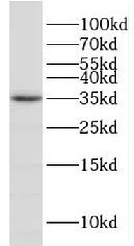 ENOPH1 Antibody