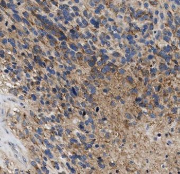 ENPP5 Antibody