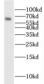 SLC29A1 Antibody