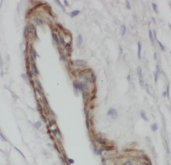 SLC29A1 Antibody