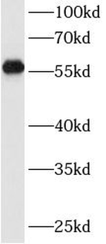 ENTPD1 Mouse Monoclonal Antibody