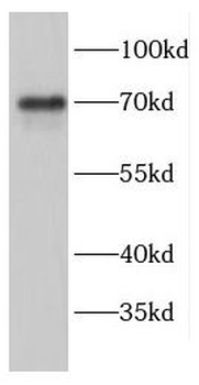 ENTPD4 Antibody
