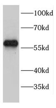 ENTPD6 Rabbit Polyclonal Antibody