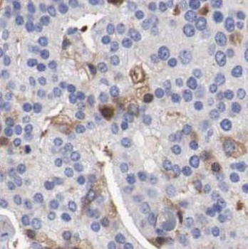 ENTPD6 Antibody