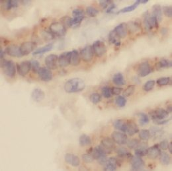 CCL11 Antibody