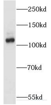 EPB41L1 Antibody