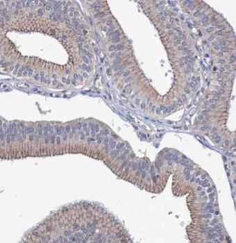 PROCR Antibody