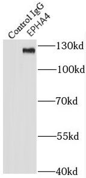 EPHA4 Antibody