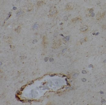 EPHA6 Antibody