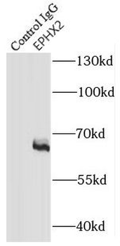 EPHX2 Antibody