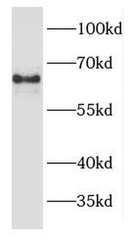 EPHX2 Antibody