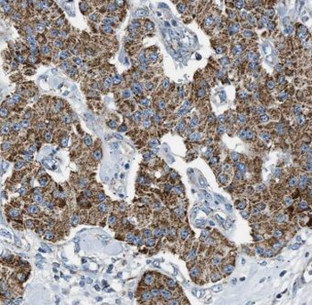 EPHX2 Antibody