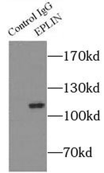 LIMA1 Antibody