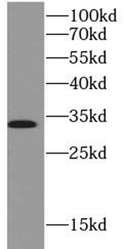 EPO Rabbit Polyclonal Antibody