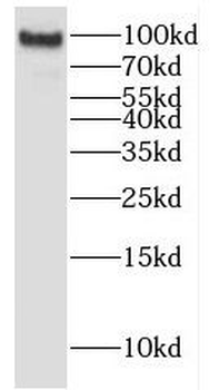 EPS8 Antibody