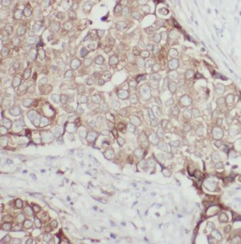 EPS8 Antibody