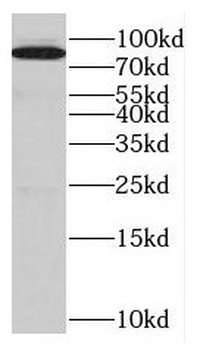 EPS8L2 Antibody