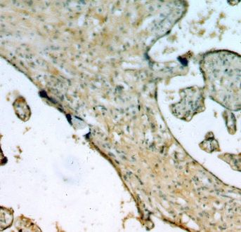 EPS8L2 Antibody