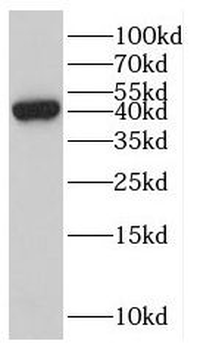 EPSTI1 Rabbit Polyclonal Antibody