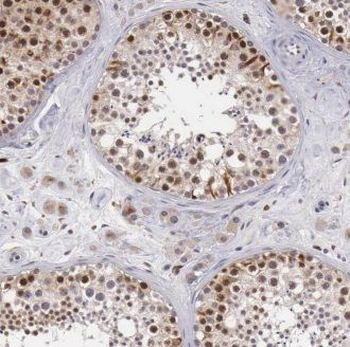 ERCC1 Antibody