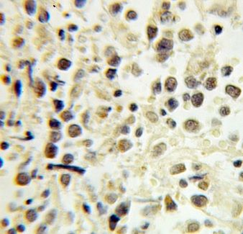 ERCC2 Antibody