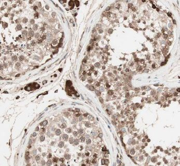 ERI1 Antibody