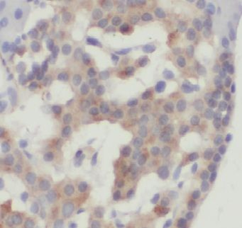 ERO1A Antibody