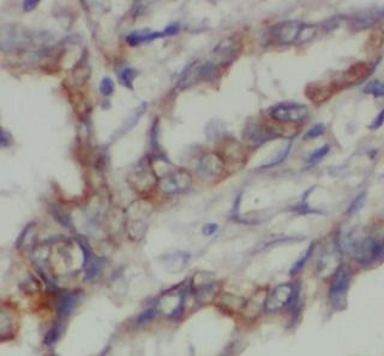 PDIA3 Antibody