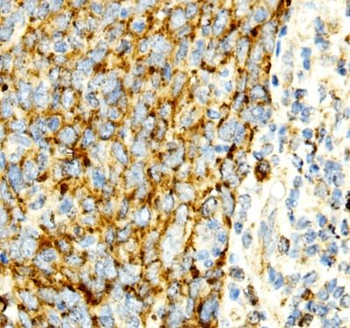 PDIA4 Antibody