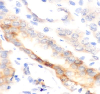 SELE Antibody