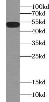 ESR2 Rabbit Polyclonal Antibody