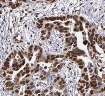 ESR2 Rabbit Polyclonal Antibody
