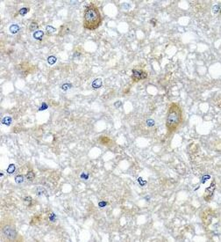 ETFA Antibody