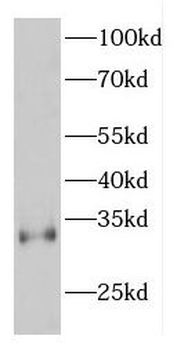 ETFB Antibody
