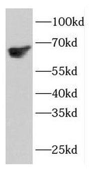 ETFDH Antibody