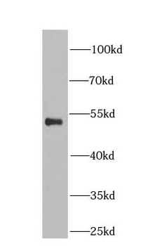 ETS1 Rabbit Polyclonal Antibody