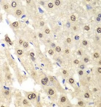 ETS1 Rabbit Polyclonal Antibody