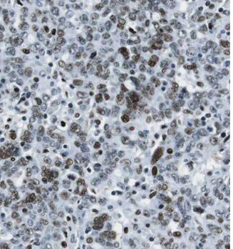 ETV4 Antibody