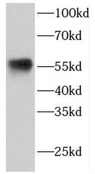 ETV6 Rabbit Polyclonal Antibody