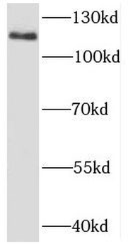 MECOM Rabbit Polyclonal Antibody