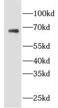 EVI2B Antibody