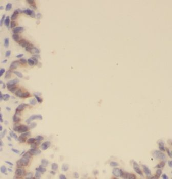 EVI2B Antibody