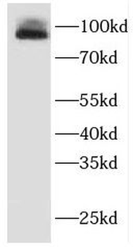 EWSR1 Rabbit Polyclonal Antibody