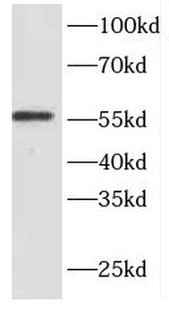 EXD2 Antibody