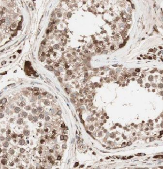 EXD2 Antibody