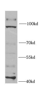 EXO1 Antibody