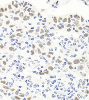 EXO1 Antibody