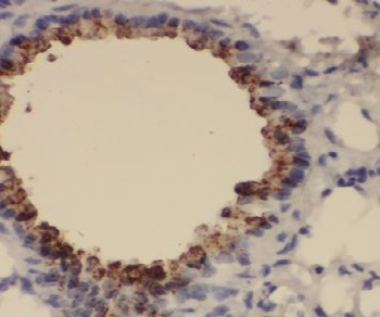 EXOSC1 Antibody