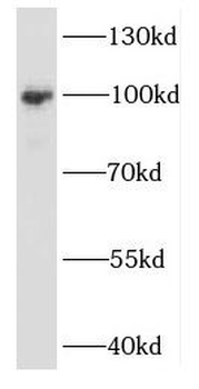 EXOSC10 Antibody