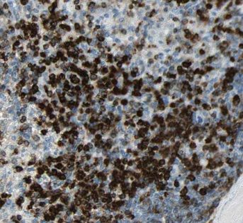 EXOSC10 Antibody